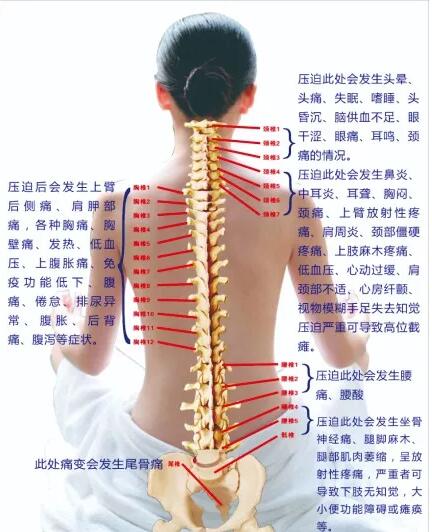 保護(hù)腰椎—示范腰椎保健操，趕快收藏吧