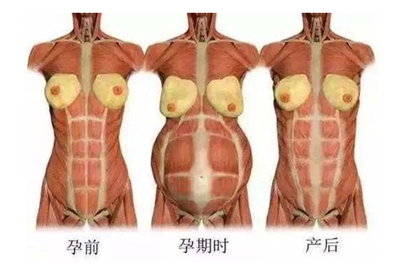 產后媽媽骨盆修復――帶你回到完美身材！