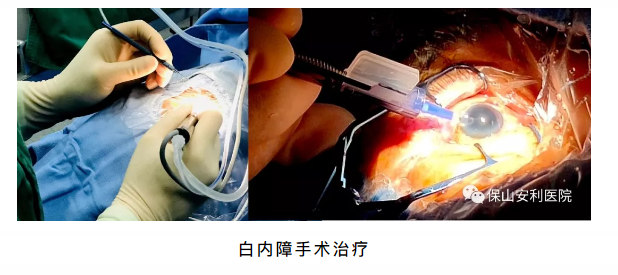 相約星期六，省級眼科、心內(nèi)科專家到院坐診、開展手術(shù)治療