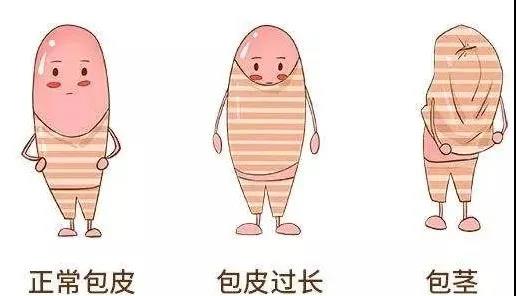 【保山安利醫(yī)院】家長(zhǎng)速看！暑期包皮手術(shù)預(yù)約正當(dāng)時(shí)！